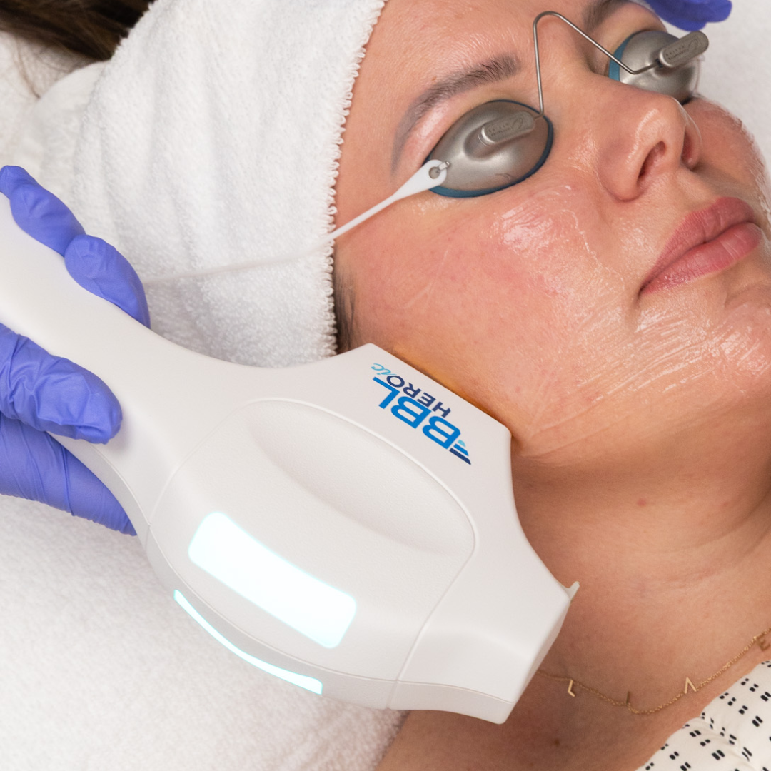 BBL Phototherapy